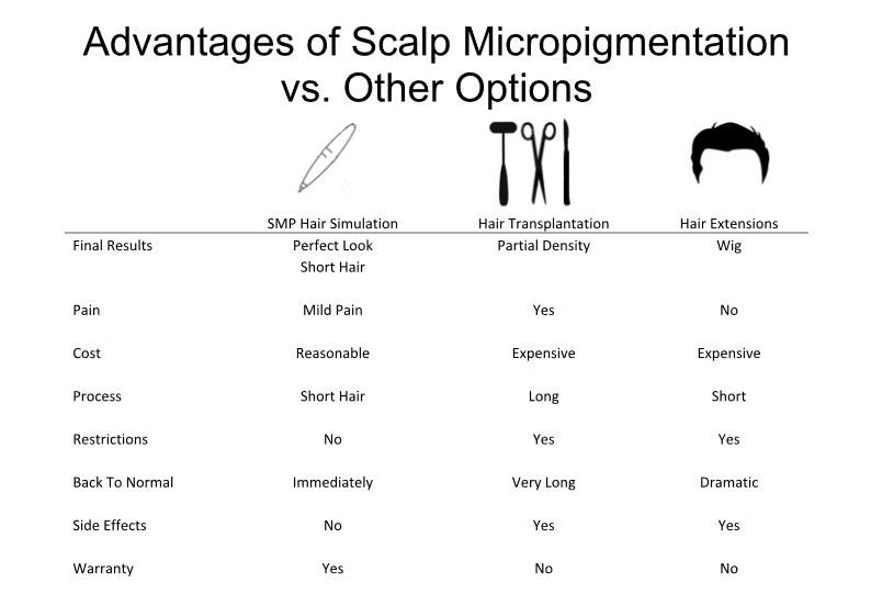 Advantages of SMP vs Other Options