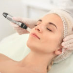 What to Know About Microneedling | Laguna Med Spa