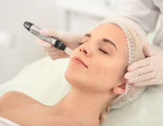 What to Know About Microneedling | Laguna Med Spa
