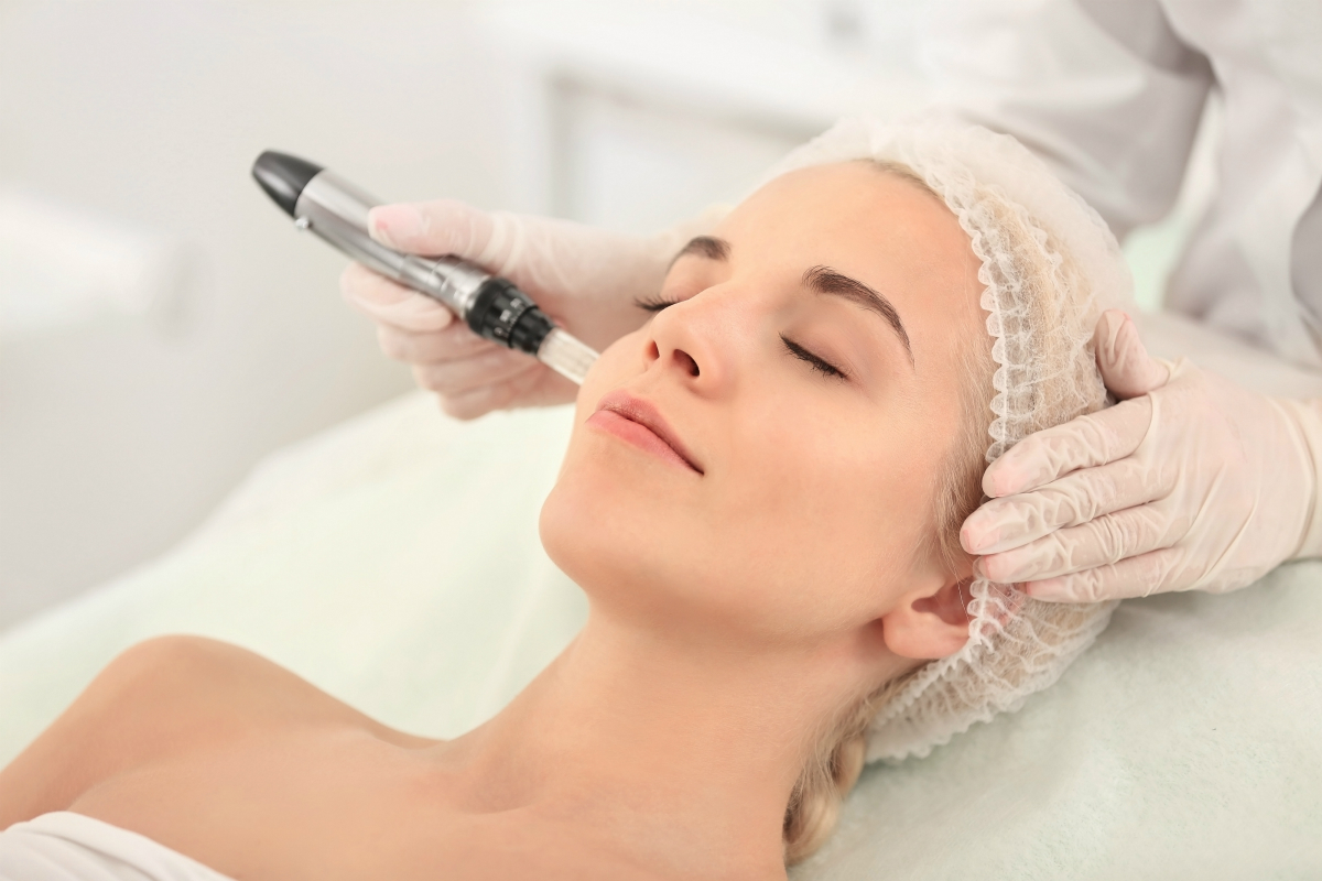 What to Know About Microneedling | Laguna Med Spa