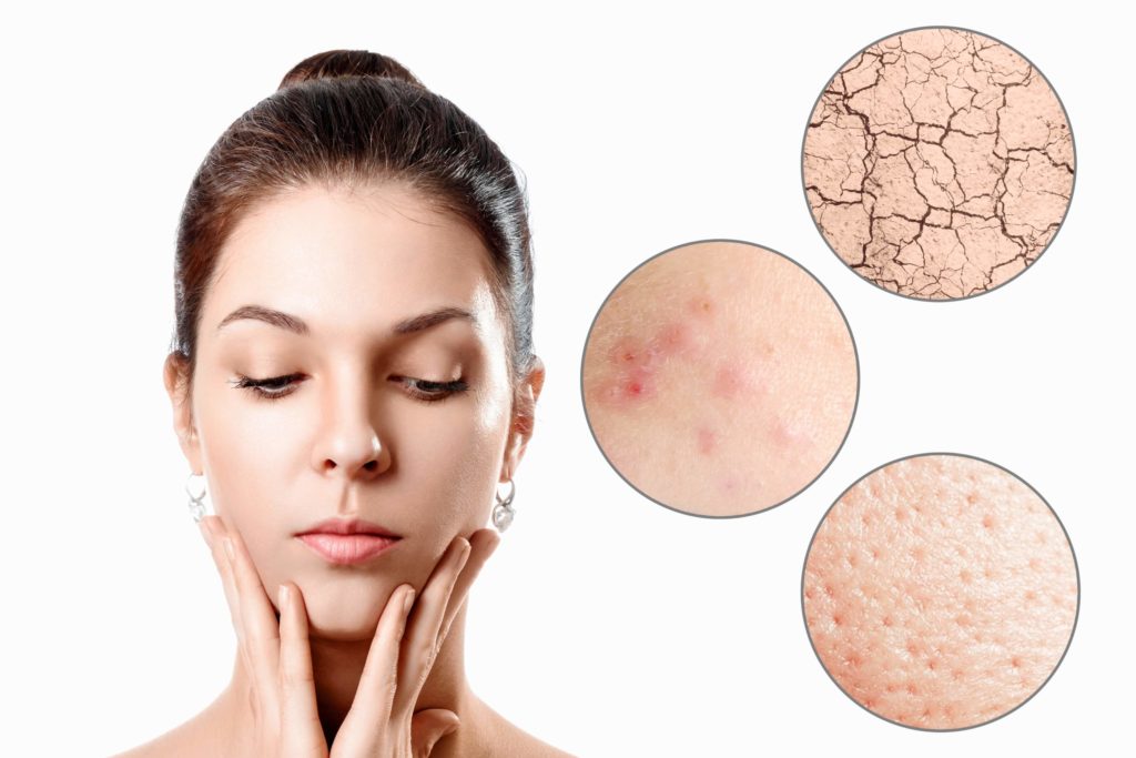 Skin Irregularities scaled