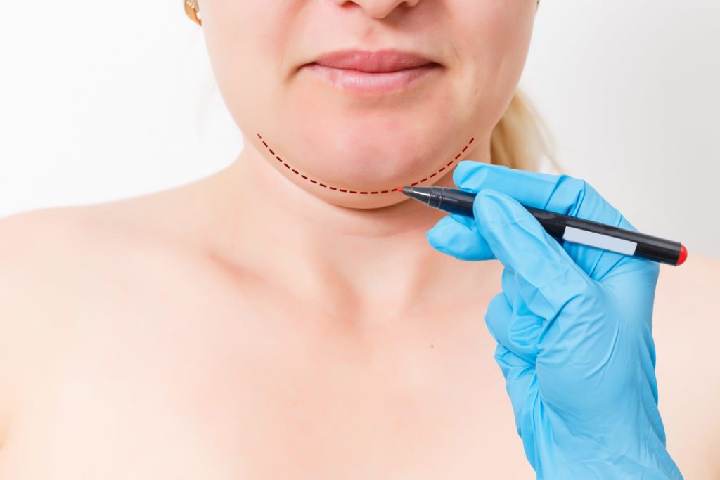 double chin scaled