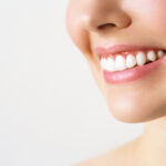 DaVinci teeth whitening, parker CO