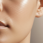 Microneedling Results