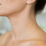 Botox for Turkey Neck in Parker, CO - Laguna Med Spa