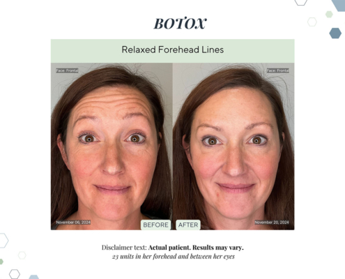 Before and After - In progress - 11