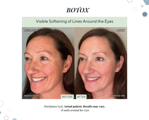 Before and After - In progress - 12