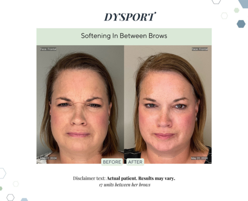 Before and After - In progress - 20