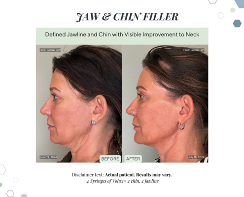 Before and After - In progress - 89