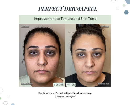 Before and After - In progress - 64