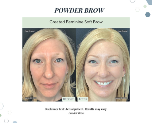 Before and After - In progress - 31