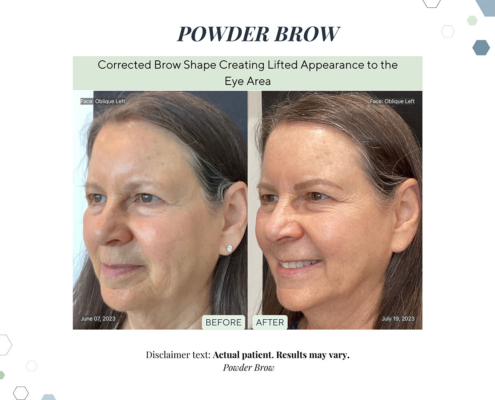 Before and After - In progress - 34