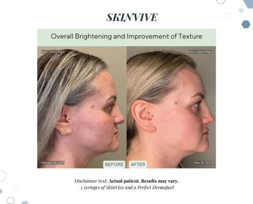 Before and After - In progress - 26