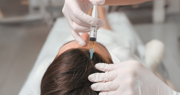 Hair Restoration Parker CO