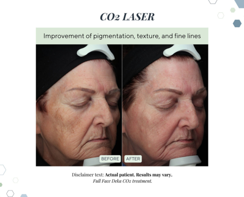 New Before and Afters AUG 2025 - 2