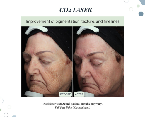 New Before and Afters AUG 2025 - 3