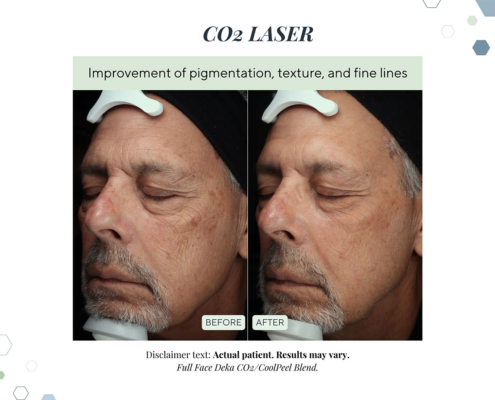 New Before and Afters AUG 2025 - 4