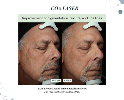 New Before and Afters AUG 2025 - 5