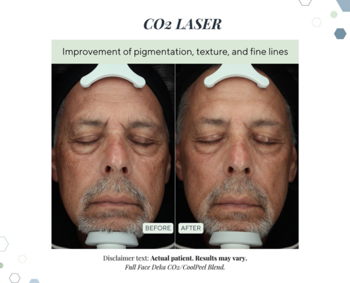 New Before and Afters AUG 2025 - 6