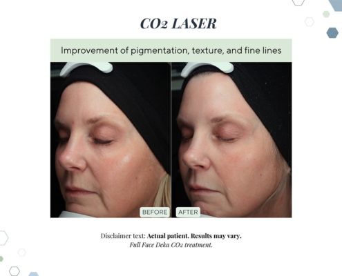 New Before and Afters AUG 2025 - 7