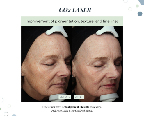 New Before and Afters AUG 2025 - 8