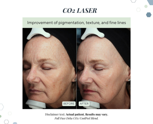 New Before and Afters AUG 2025 - 9