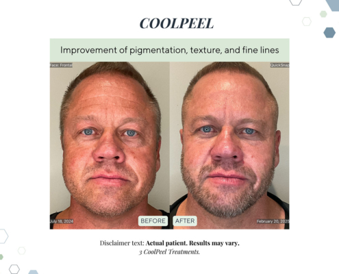 New Before and Afters AUG 2025 - 6