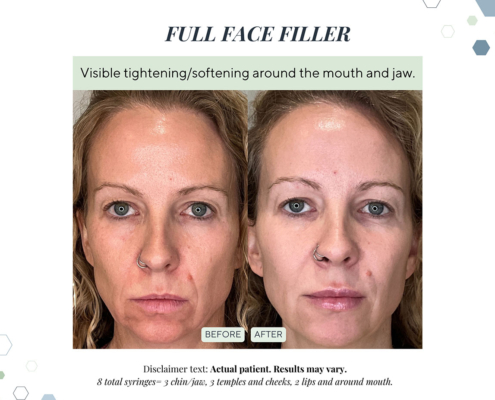 New Before and Afters AUG 2025 - 7