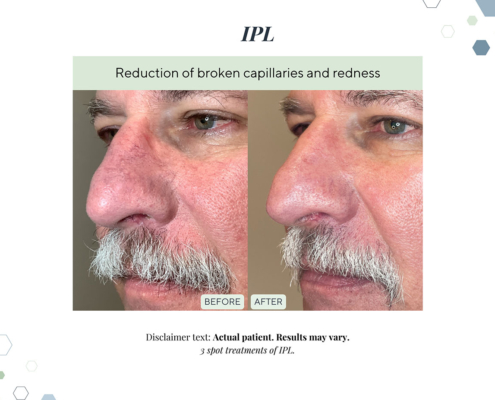 New Before and Afters AUG 2025 - 8