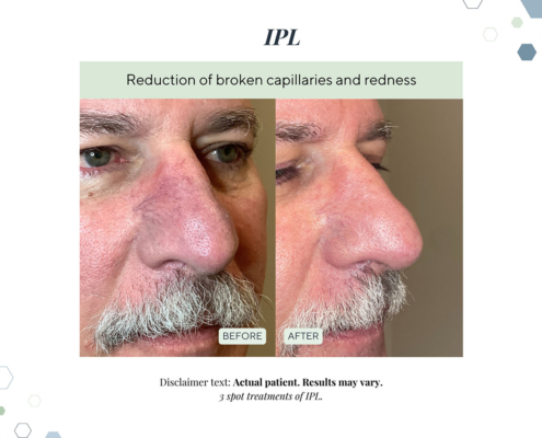 New Before and Afters AUG 2025 - 9