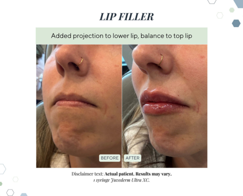 New Before and Afters AUG 2025 - 4