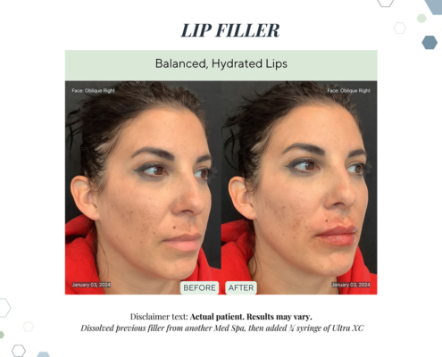 Before and After - In progress - 79