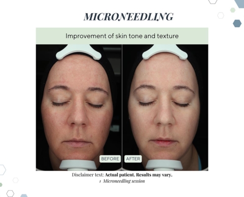 New Before and afters OCT 2025 - 12