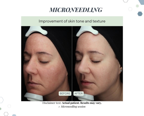 New Before and afters OCT 2025 - 13