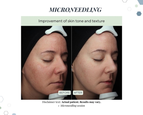 New Before and afters OCT 2025 - 14