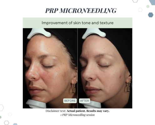 New Before and afters OCT 2025 - 10