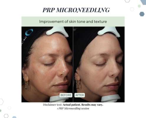 New Before and afters OCT 2025 - 11