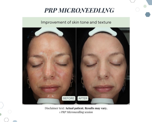 New Before and afters OCT 2025 - 9