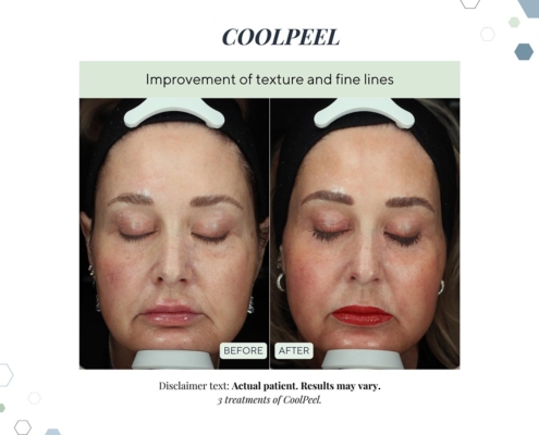 New Before and afters OCT 2025 - 1