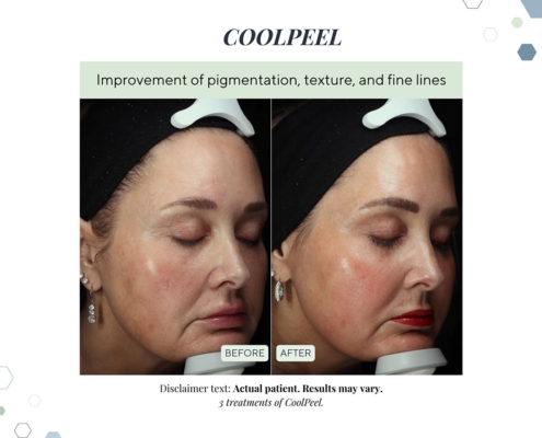 New Before and afters OCT 2025 - 2