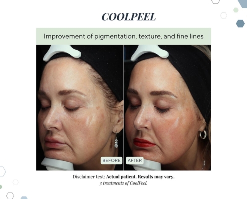 New Before and afters OCT 2025 - 3