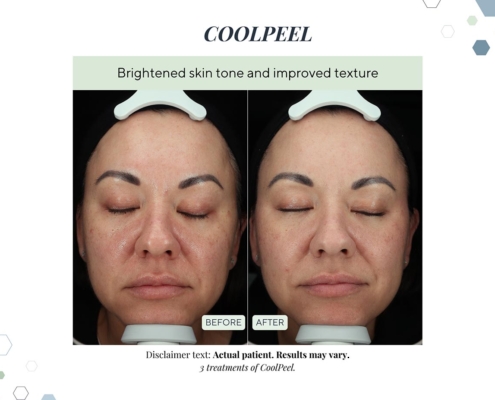 New Before and afters OCT 2025 - 4