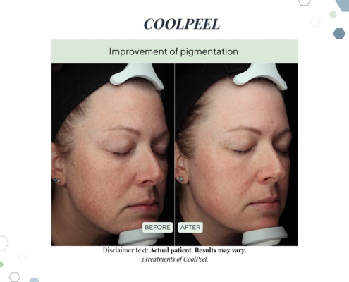 New Before and afters OCT 2025 - 5