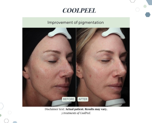 New Before and afters OCT 2025 - 6