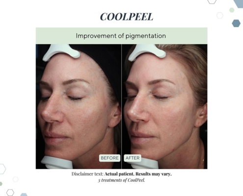 New Before and afters OCT 2025 - 7