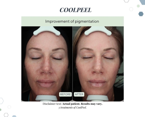 New Before and afters OCT 2025 - 8