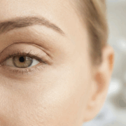 PDGF Under-Eye Treatment