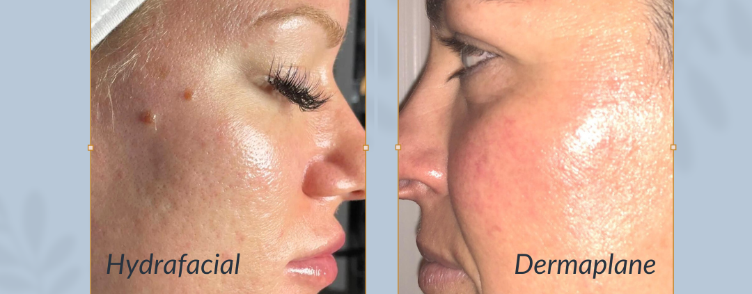 hydrafacial vs dermaplaning parker co